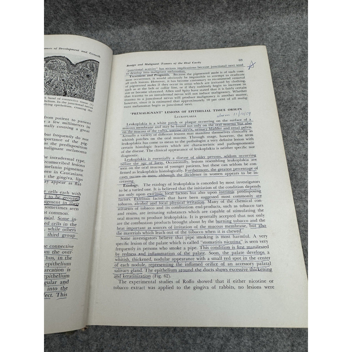 1958 A Textbook of Oral Pathology Shafer Hine Levy HC Illustrated Dentistry
