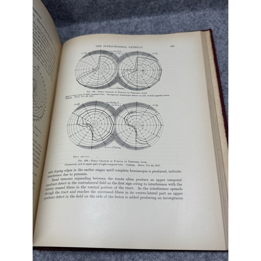 1938 Clinical Perimetry H M Traquair 3rd Ed HC Mosby Ophthalmology