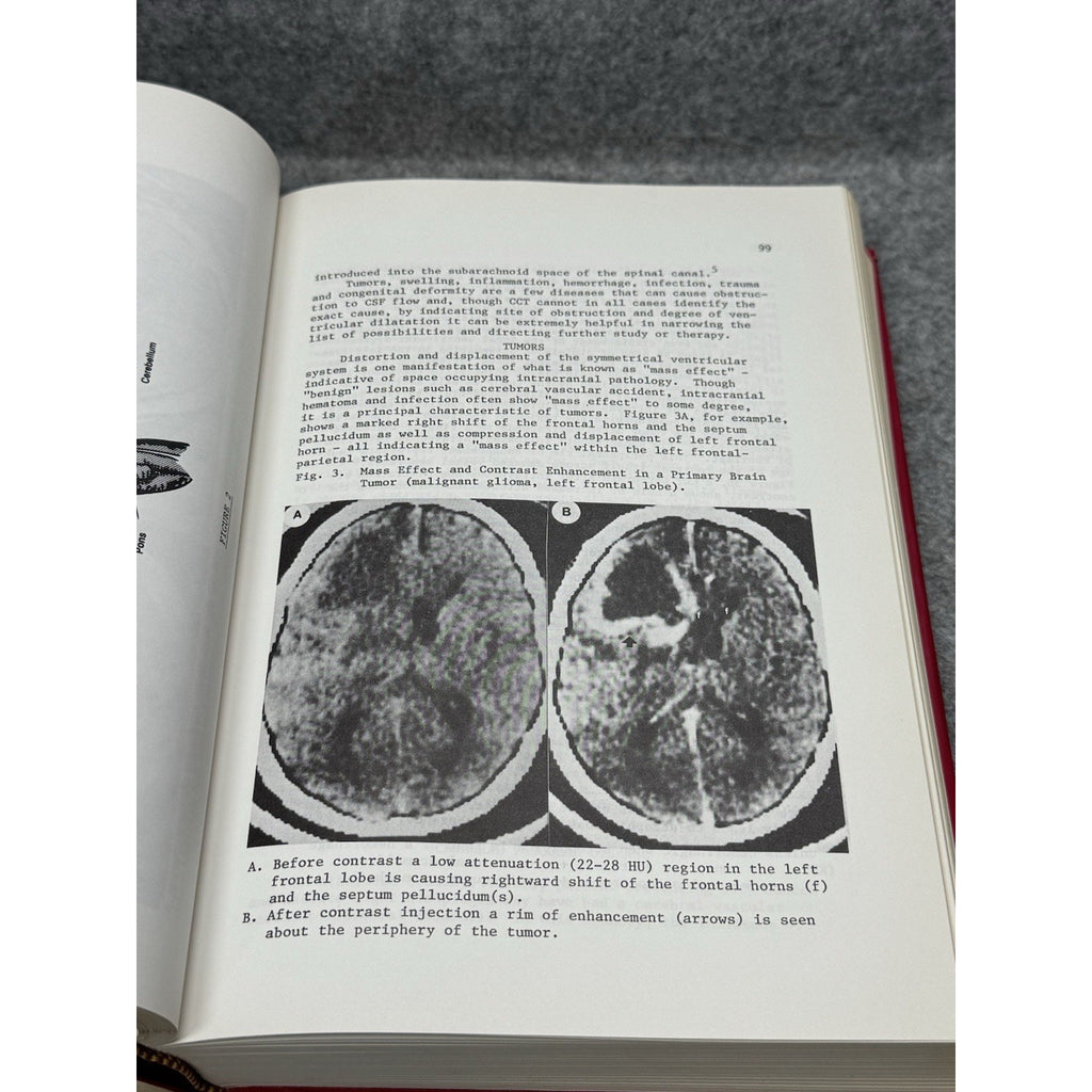 Scarce 1980 Medical Physics of CT & Ultrasound Fullerton Zagzebski HC DJ