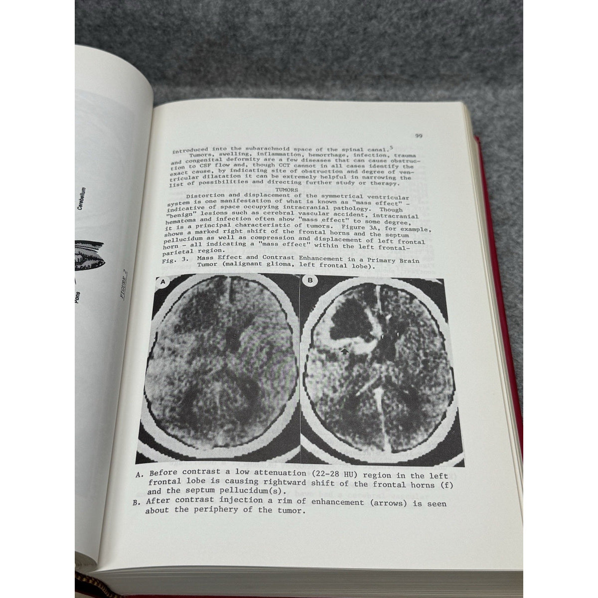 Scarce 1980 Medical Physics of CT & Ultrasound Fullerton Zagzebski HC DJ