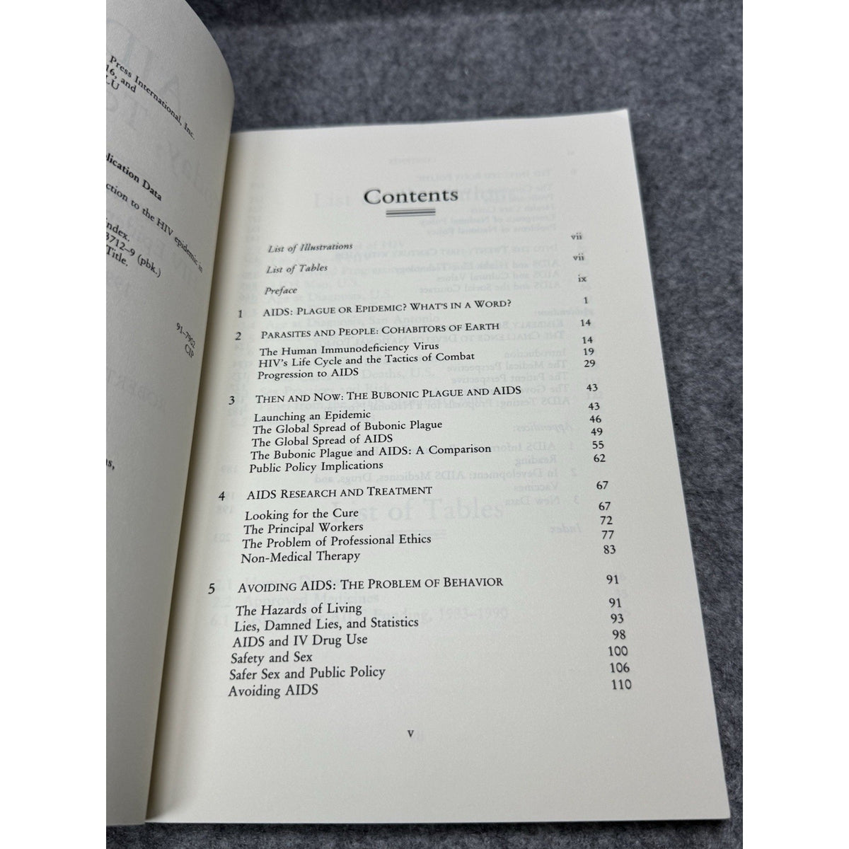 AIDS Today Tomorrow Robert Searles Walker 1992 HIV Epidemic in America