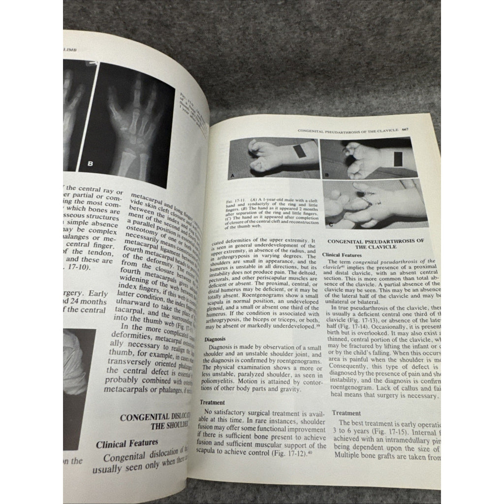 Pediatric Orthopaedics Vol. 2 by Lovell, Wood W.; Winter, Robert B.