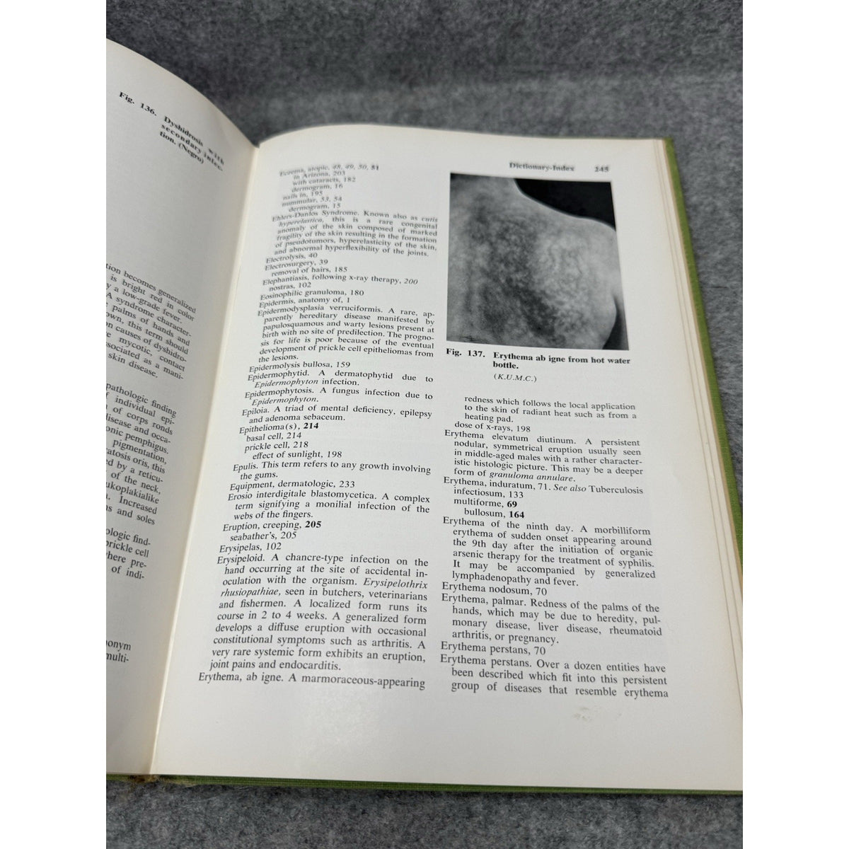 1959 Manual of Skin Diseases Gordon C Sauer Vintage Medical Illustrated HC