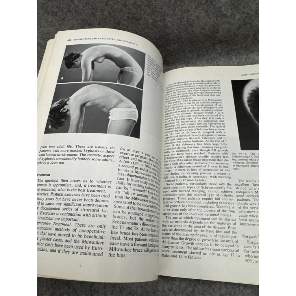 Pediatric Orthopaedics Vol. 2 by Lovell, Wood W.; Winter, Robert B.