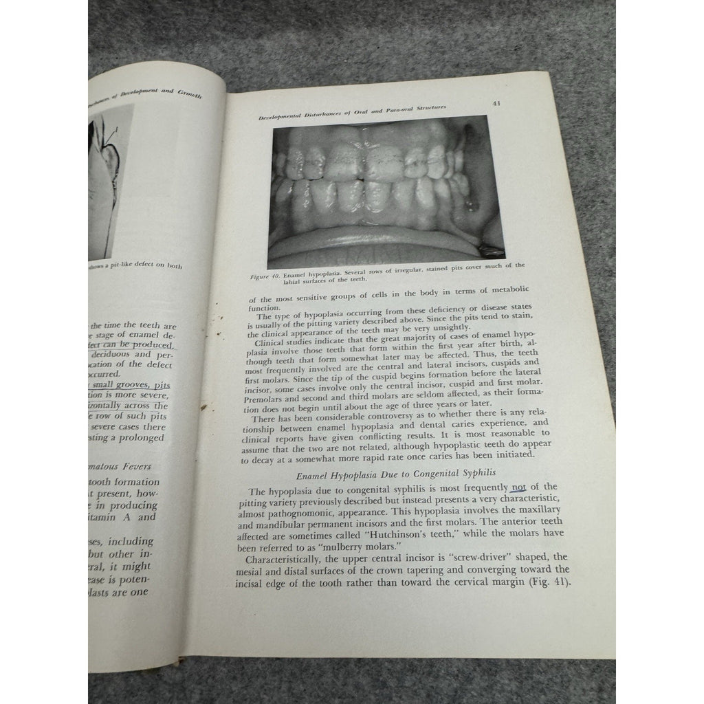 1958 A Textbook of Oral Pathology Shafer Hine Levy HC Illustrated Dentistry