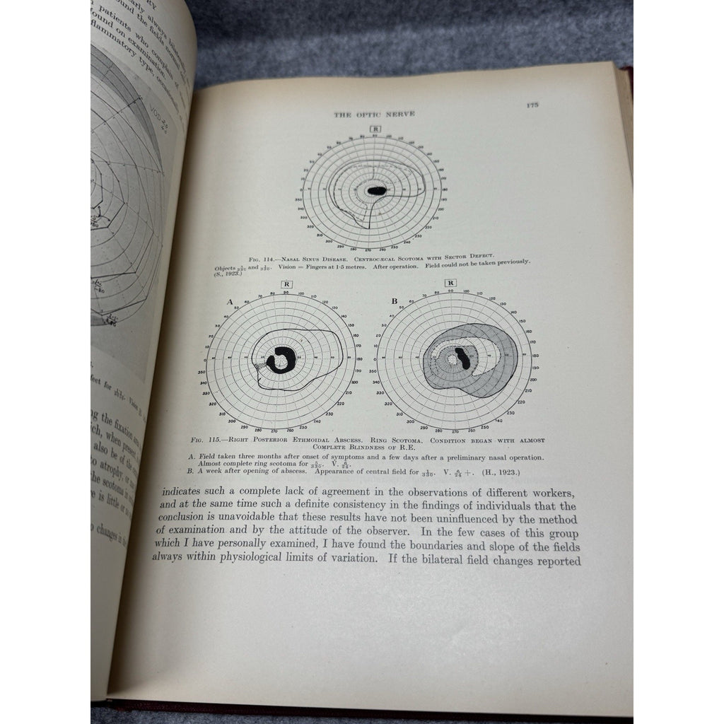 1938 Clinical Perimetry H M Traquair 3rd Ed HC Mosby Ophthalmology