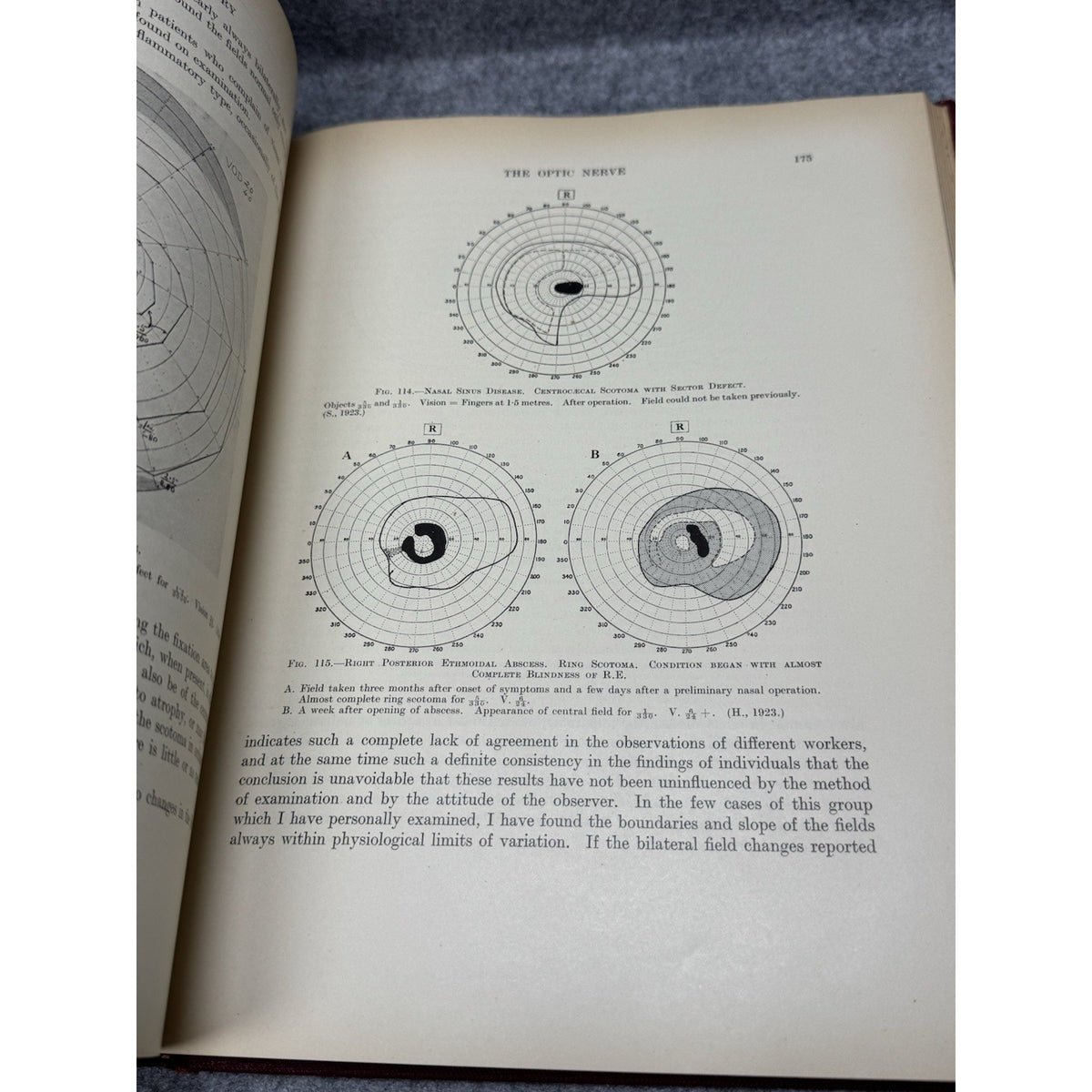 1938 Clinical Perimetry H M Traquair 3rd Ed HC Mosby Ophthalmology