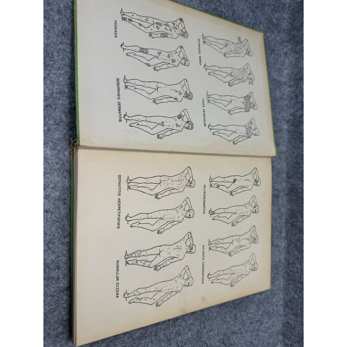 1959 Manual of Skin Diseases Gordon C Sauer Vintage Medical Illustrated HC