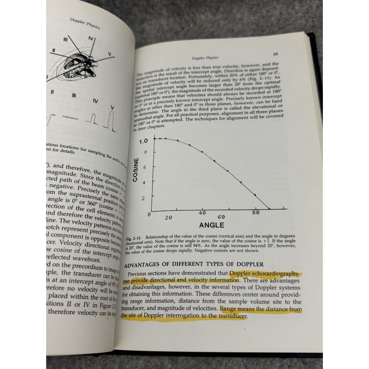 Doppler Echocardiography Stanley J. Goldberg 1985