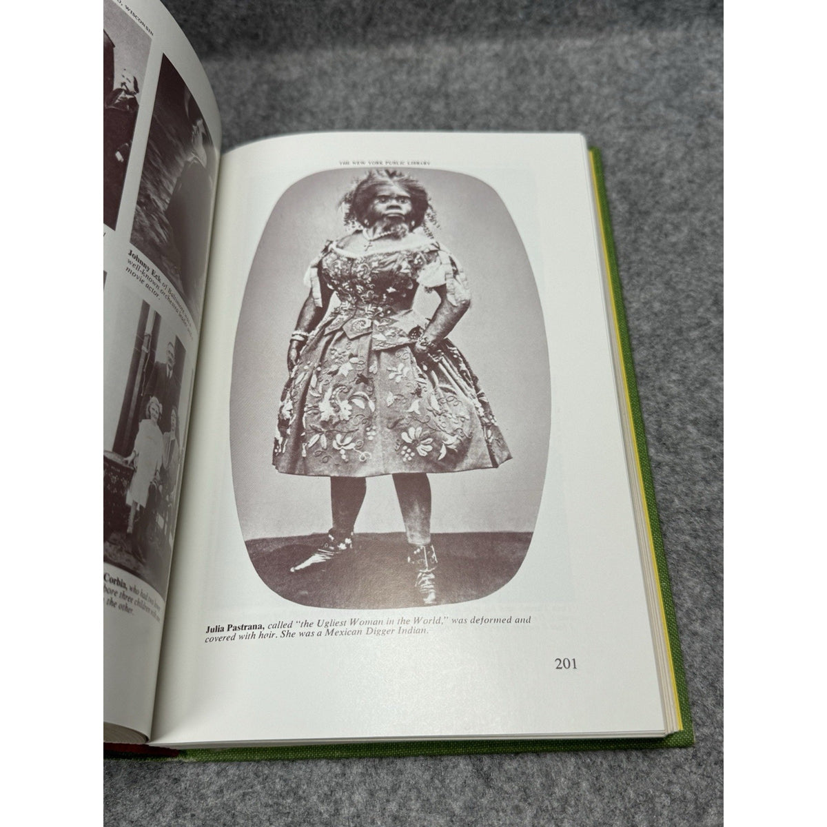 Very Special People Frederick Drimmer Human Oddities Circus History 1973 HC