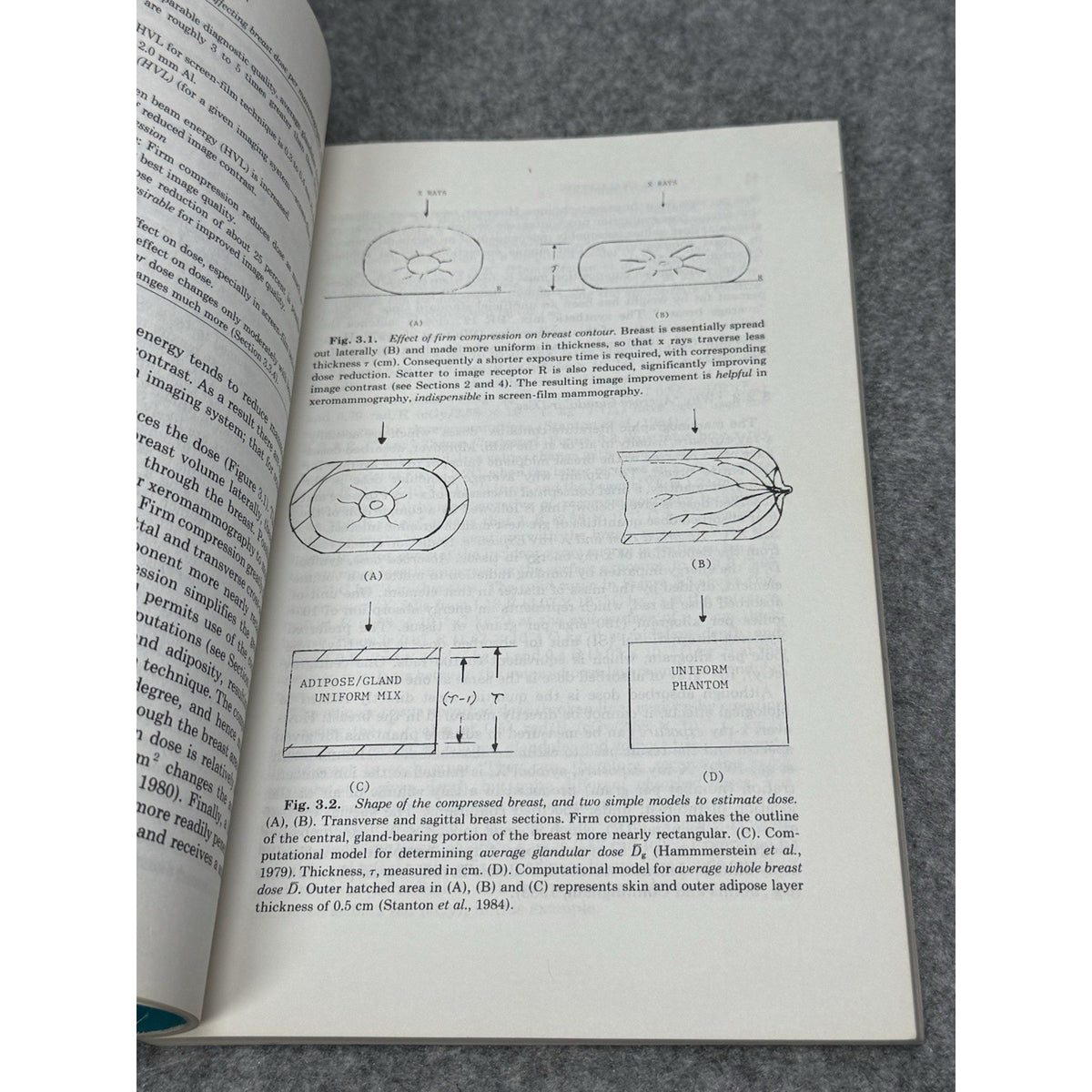 1986 Mammography A User’s Guide NCRP Report No. 85 Radiation Protection