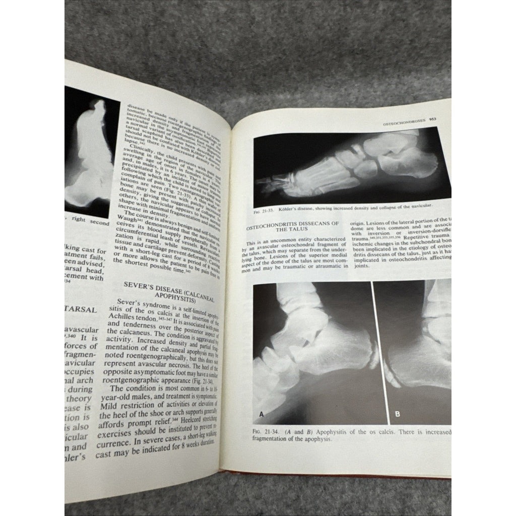Pediatric Orthopaedics Vol. 2 by Lovell, Wood W.; Winter, Robert B.