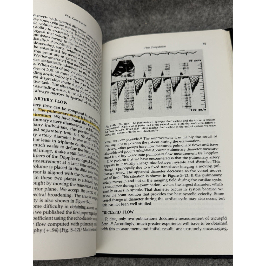Doppler Echocardiography Stanley J. Goldberg 1985