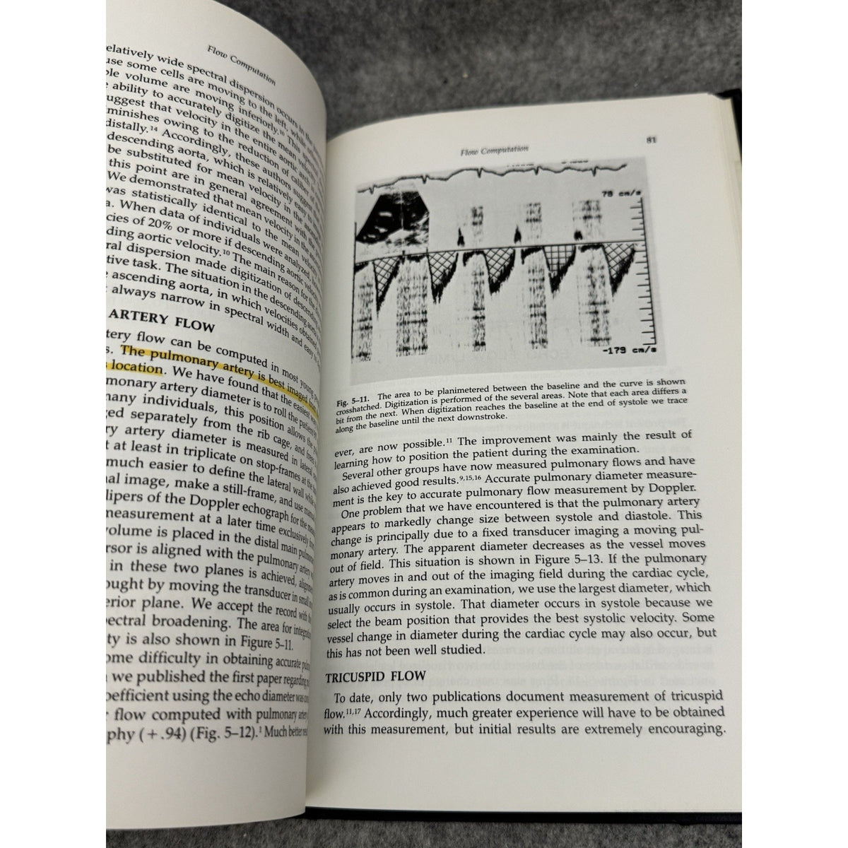 Doppler Echocardiography Stanley J. Goldberg 1985